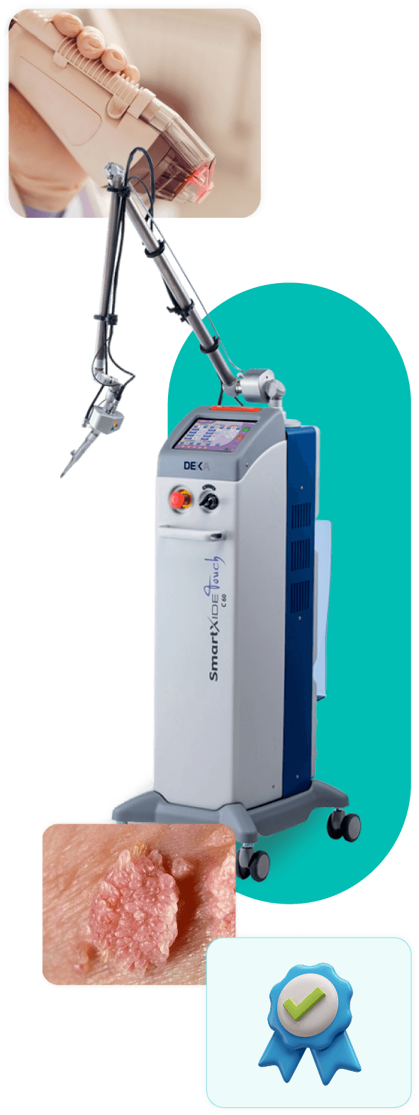 Equipo médico láser CO2